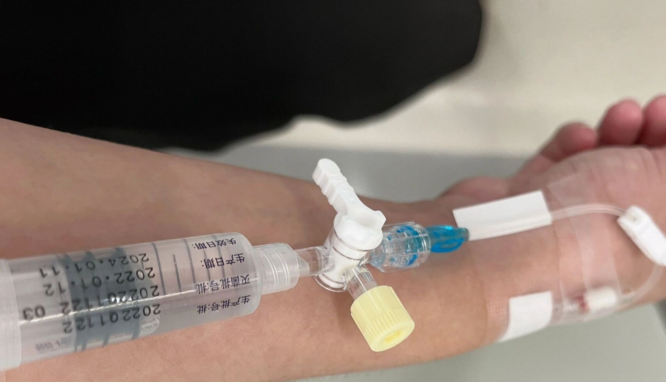 偏头痛诱因检查之经颅多普勒发泡实验 ～去检查前根本不抱希望觉得也