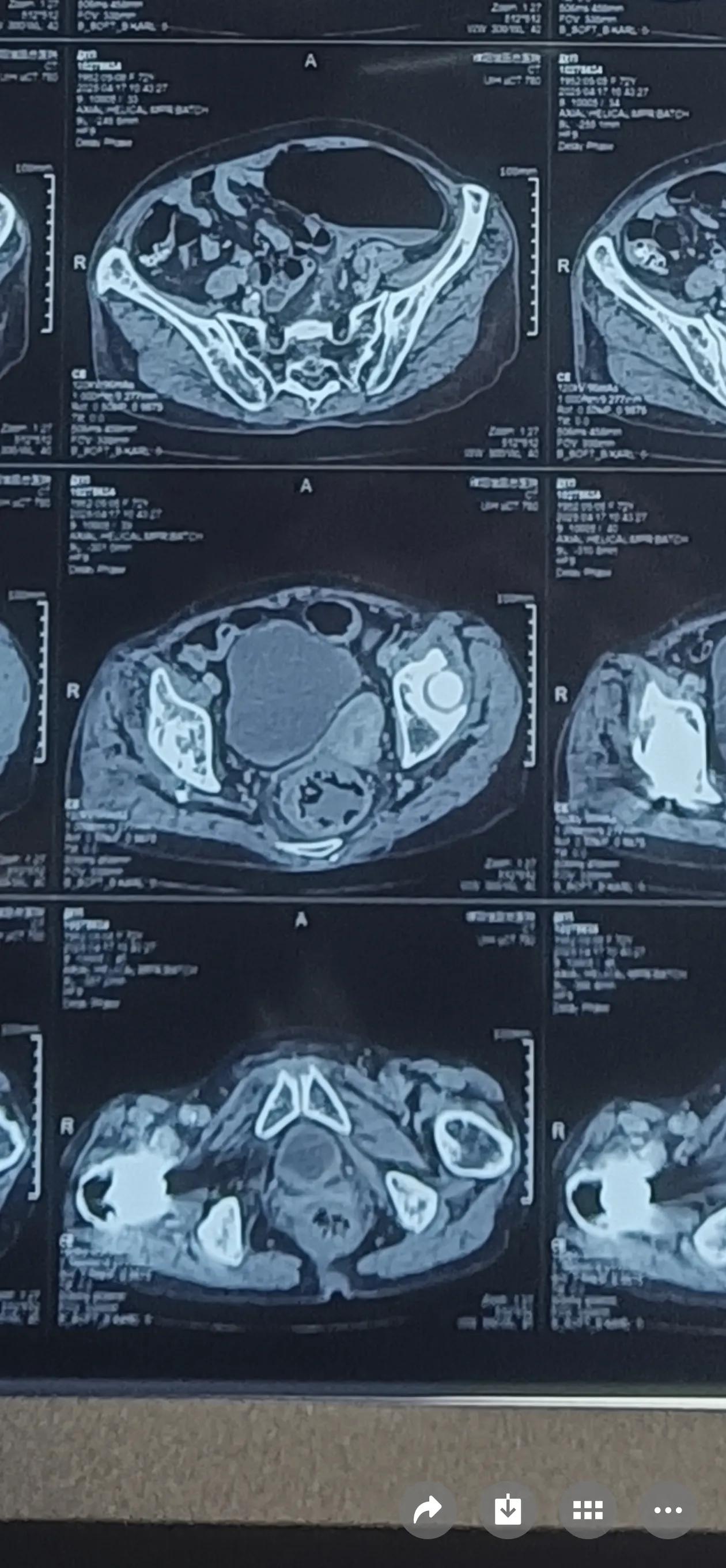 包含中国医学科学院整形外科医院健康支持CT加急的词条