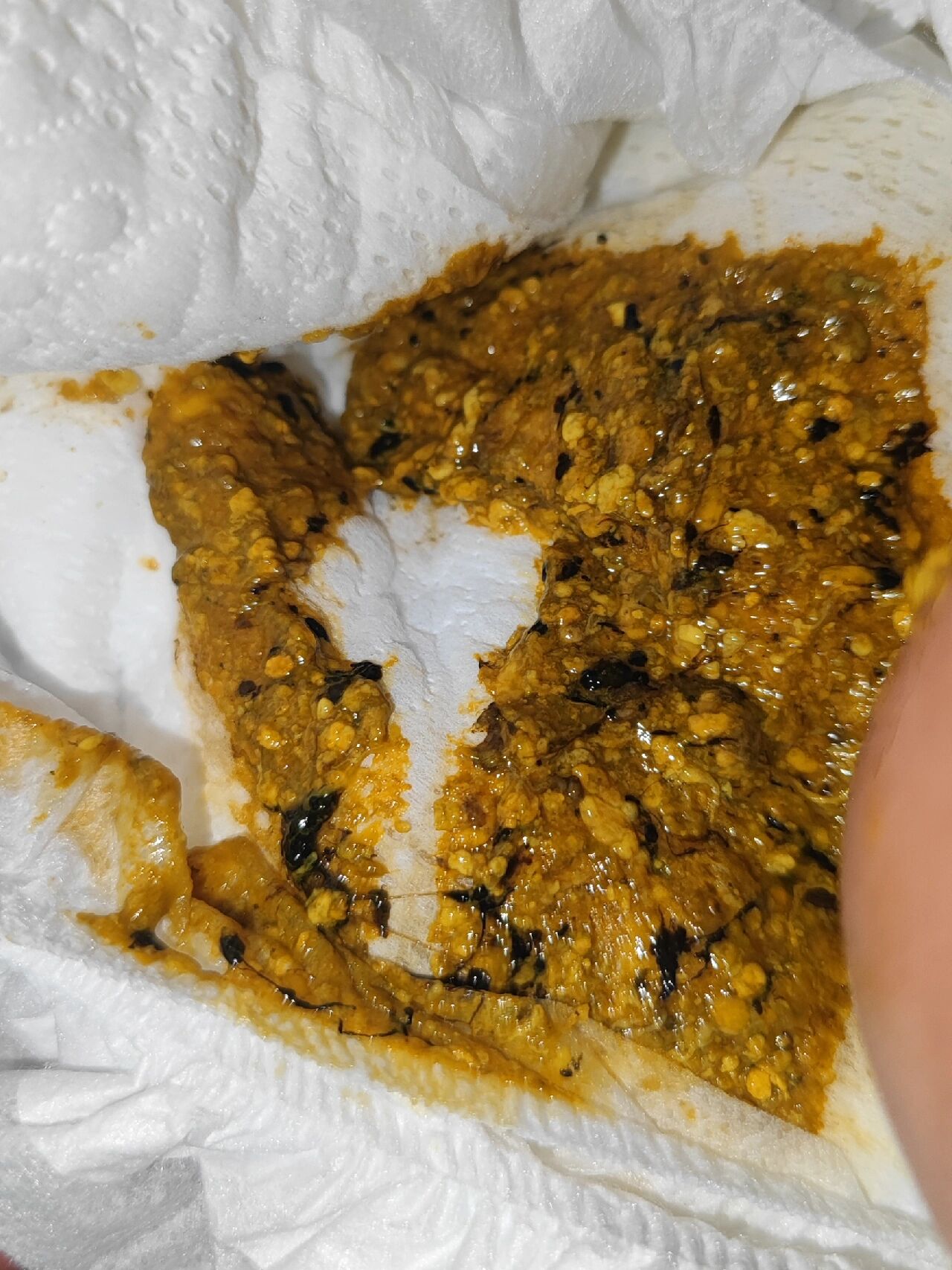 宝宝刚刚拉了不少粑粑,打开尿不湿发现里面有好多黑色絮状物,还有不少