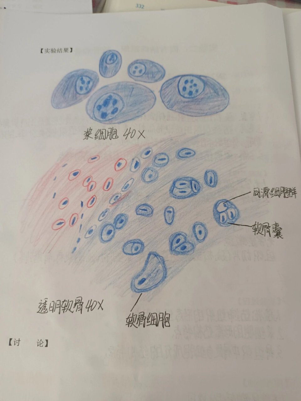 组胚透明软骨手绘图图片