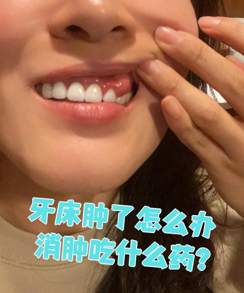 牙龈为什么肿痛