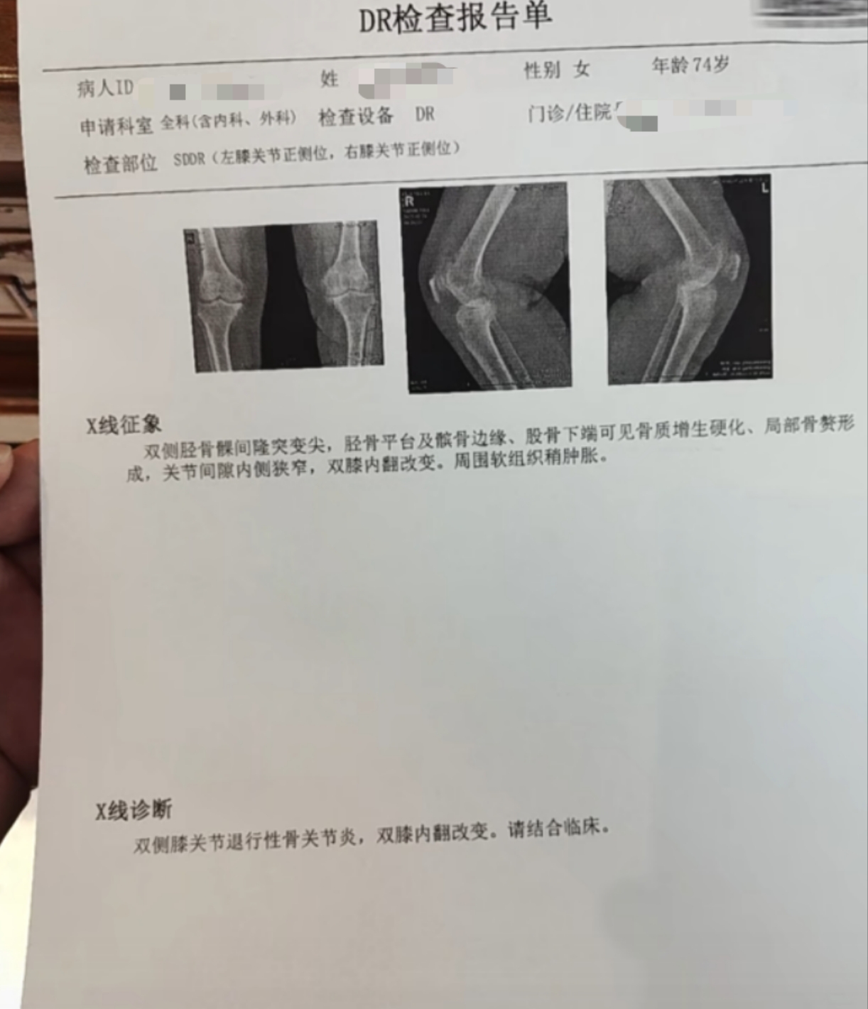 第一种情况是膝关节炎