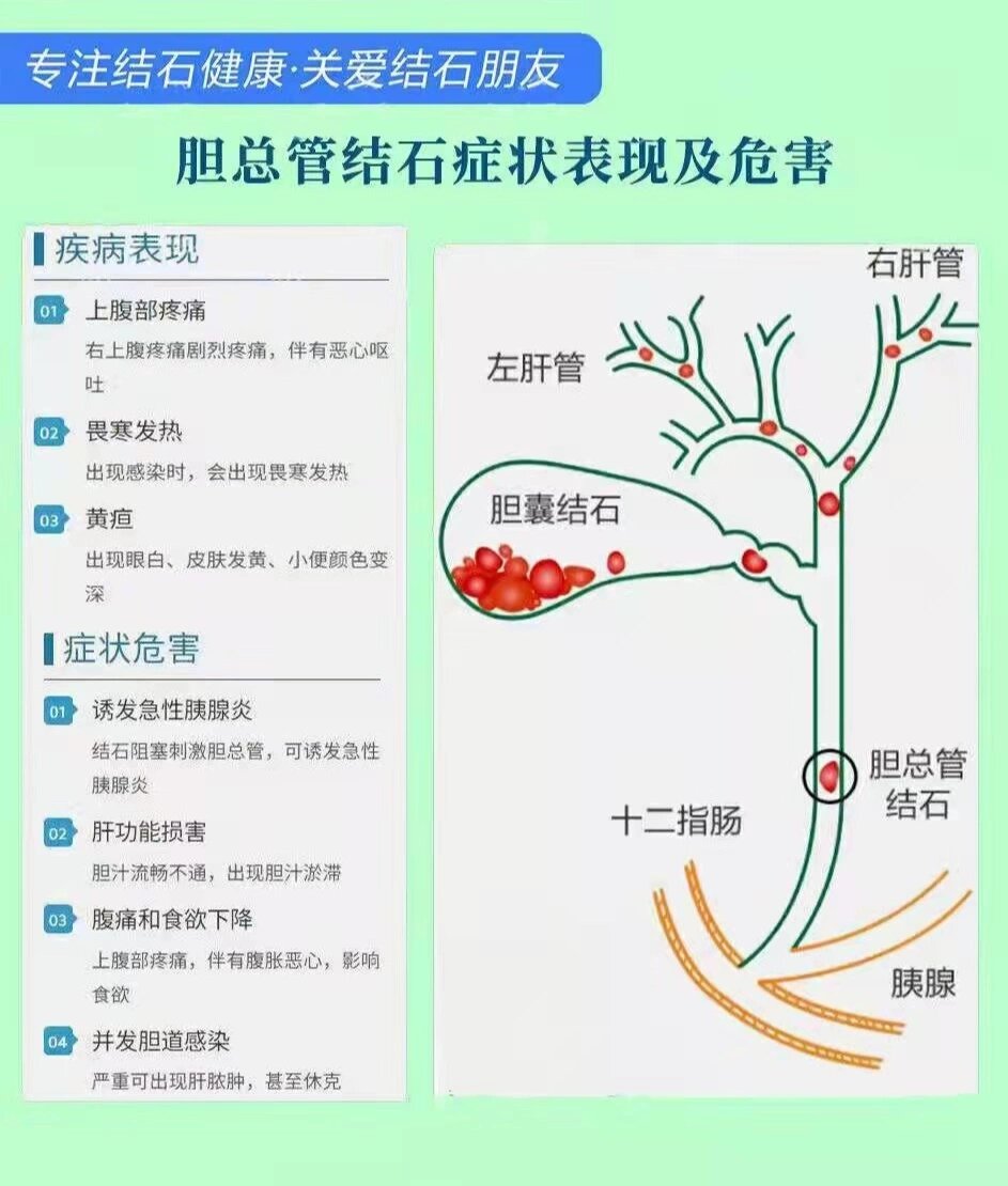 胆总管分为哪四段图片图片