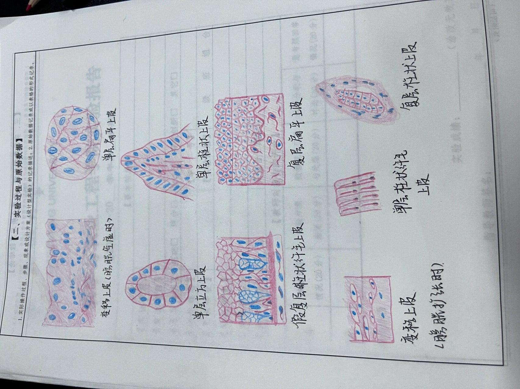 红蓝铅笔画图 1,变移上皮(膀胱空虚时) 2,单层扁平上皮 3,单层立方上