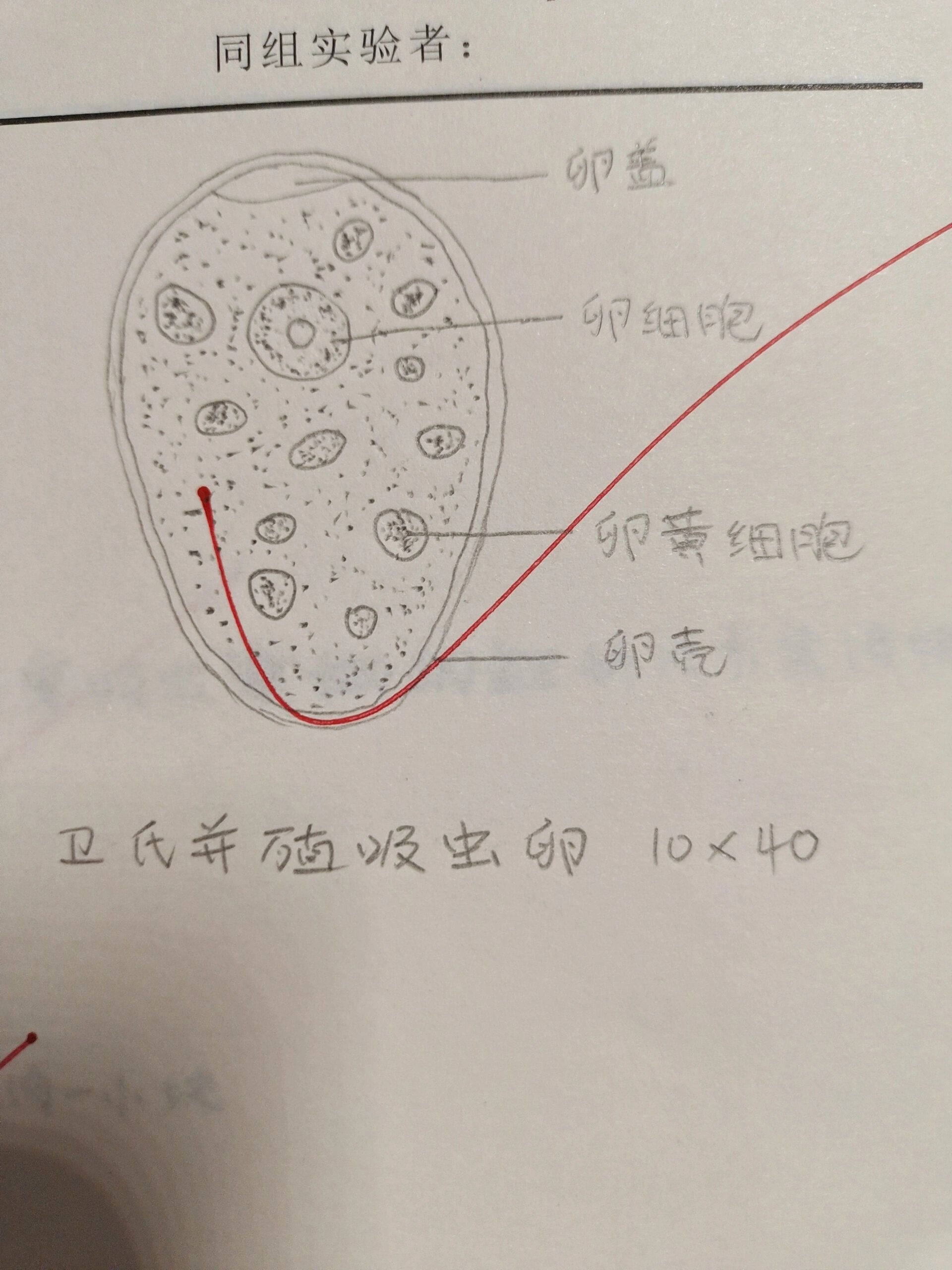 华支睾吸虫卵图片图片