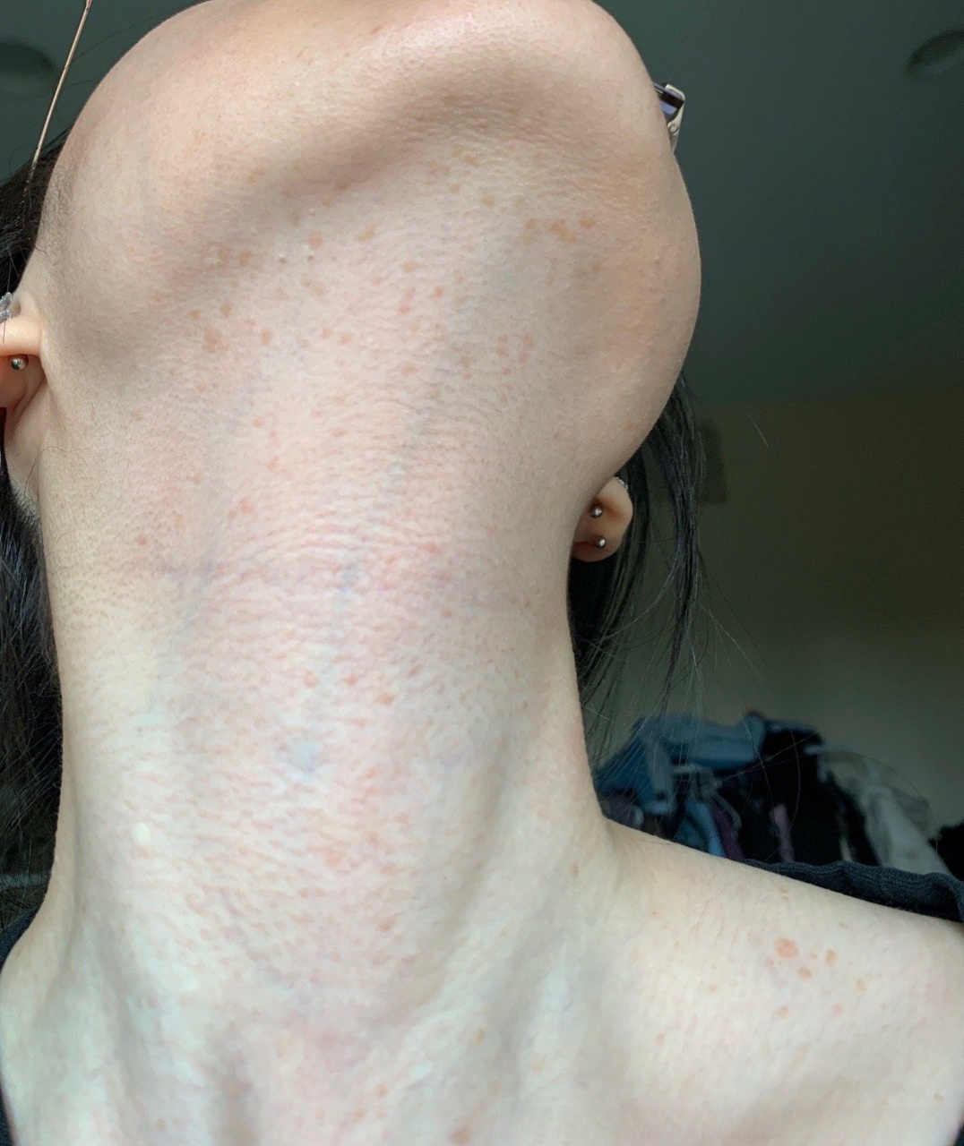 健康美好生活计划# 多年前已接种过hpv疫苗.