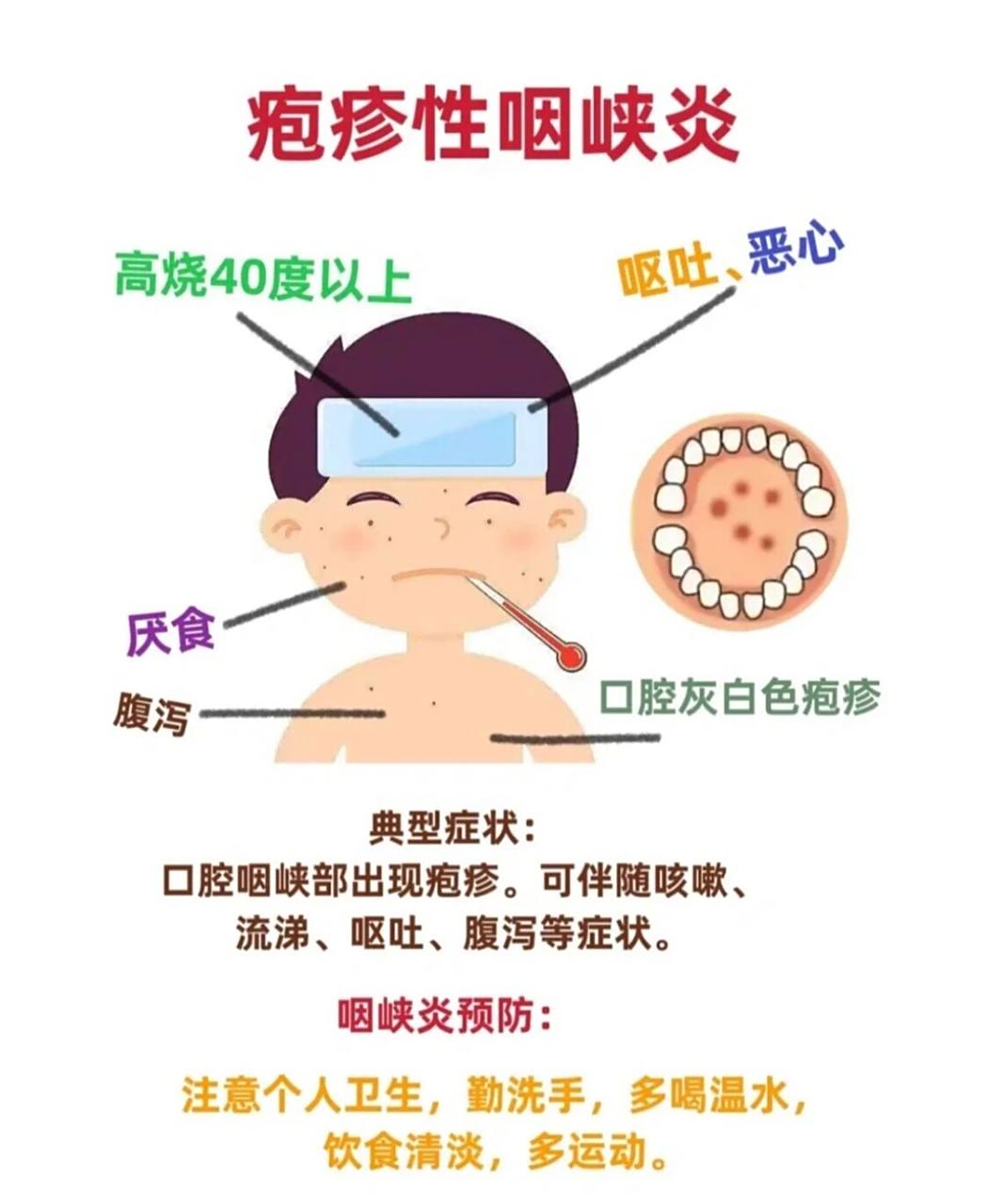 疱疹性咽峡炎 987,8,9月是疱疹炎峡咽的高峰期,它是60种一69