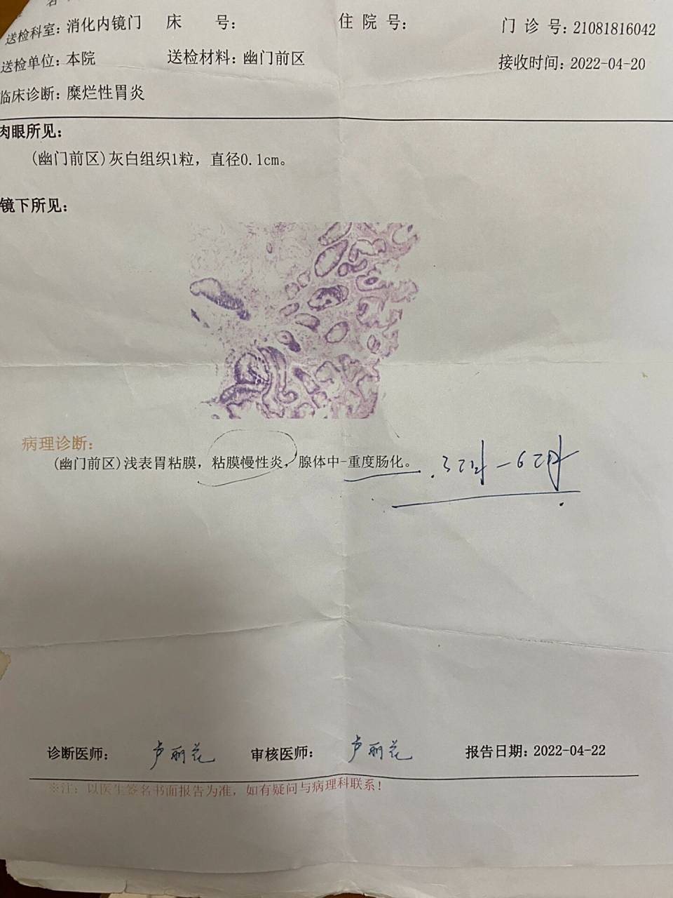 萎缩性胃炎伴中重度肠化逆转成功 对于这个病理结果,我是这么理解的