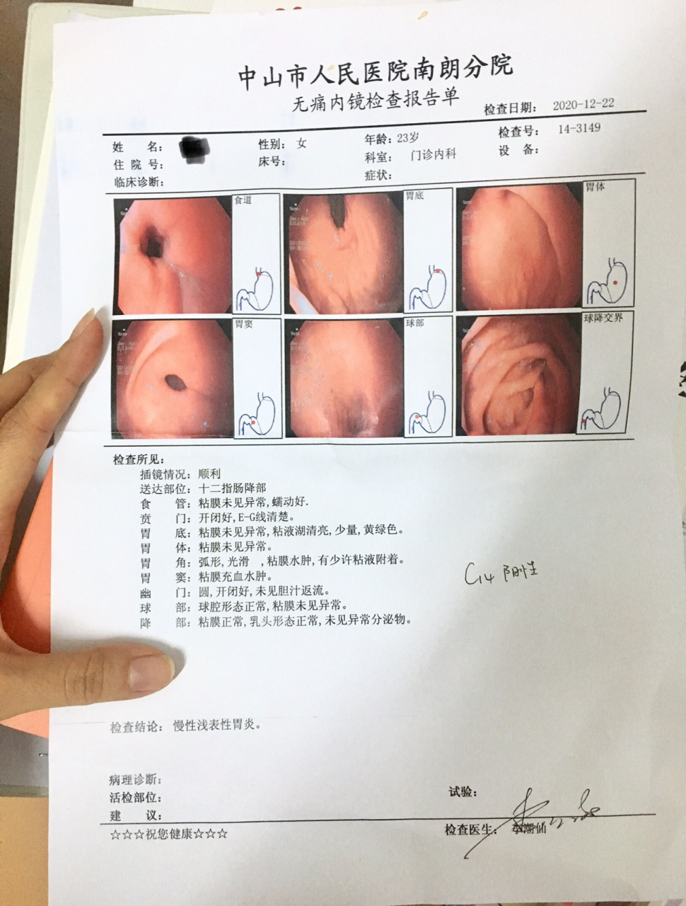 无痛胃镜检查(一)心电图篇 病症:连续三日晚饭后胃痛,短则半小时,长则