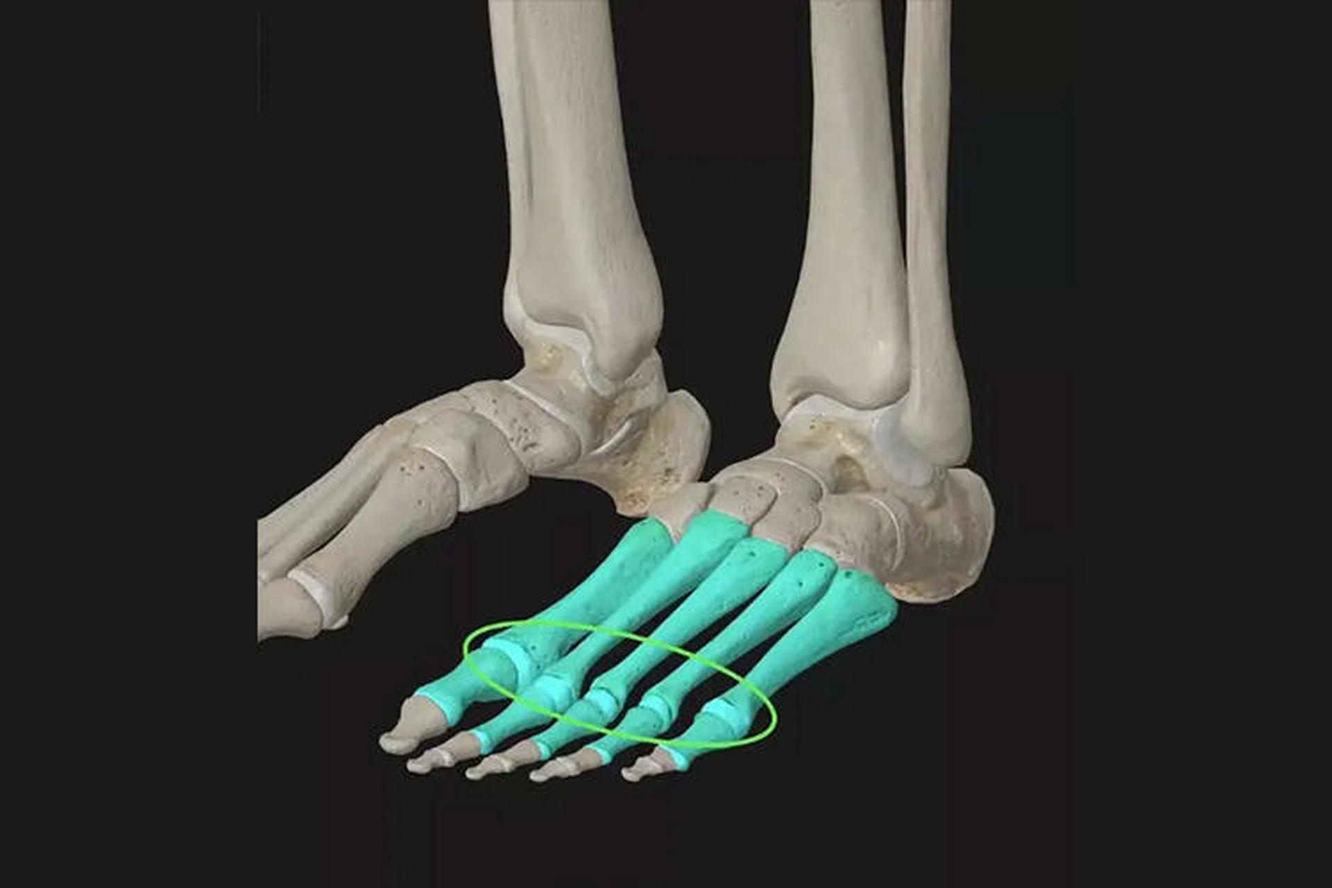 📌跖趾关节位于双侧足部,由跖骨头与近节趾骨底构成.