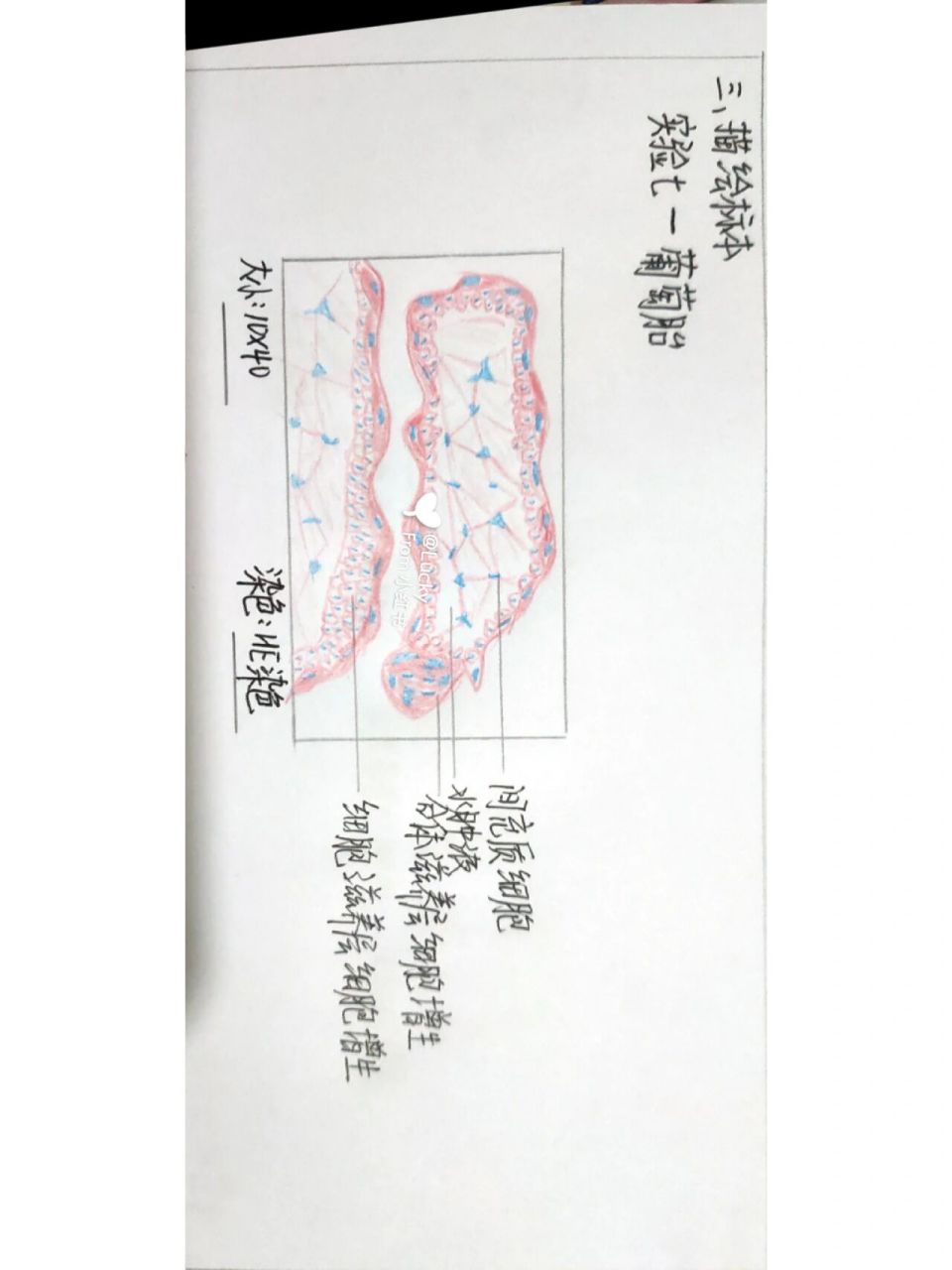 葡萄胎红蓝铅笔手绘 ,借鉴其它作者的哦