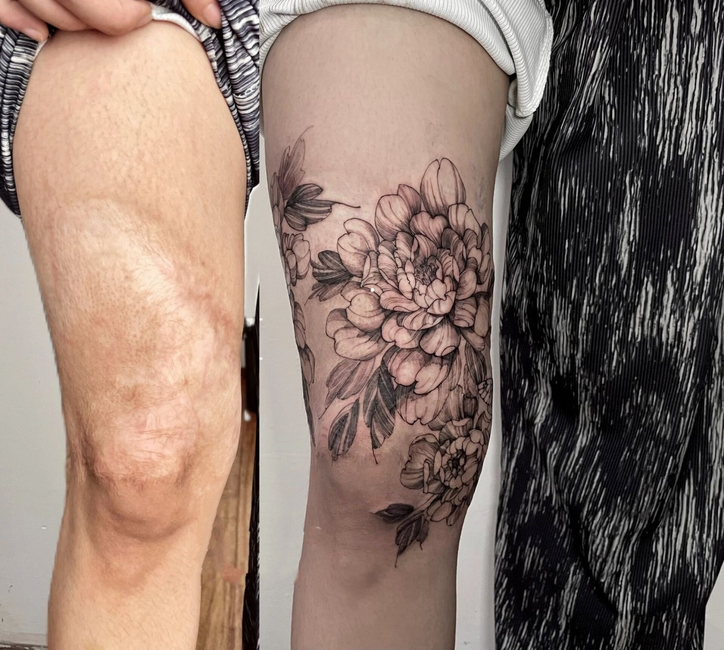 95大腿疤痕遮盖|素花纹身遮盖 客人小时候的烫伤 腿粗一圈都是 挺