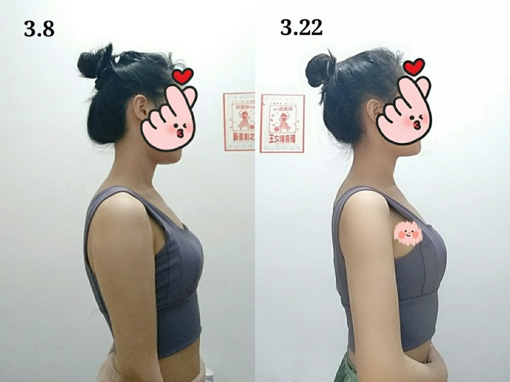 驼背改善‖15天对比图来啦! 打卡改善驼背的第15天!