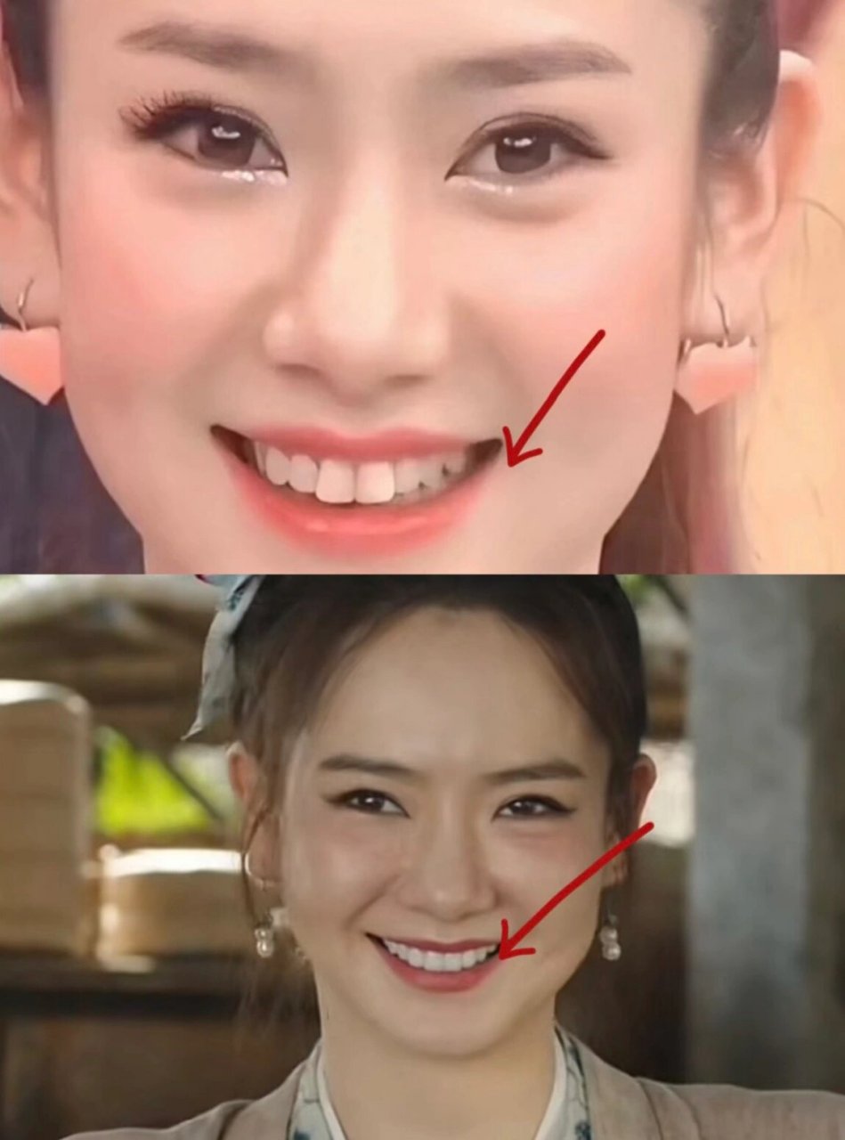 戚薇的牙齿也是假的吗?