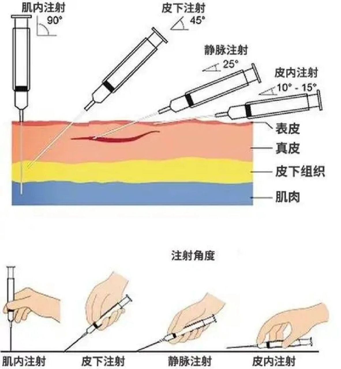 肌内注射手法图片