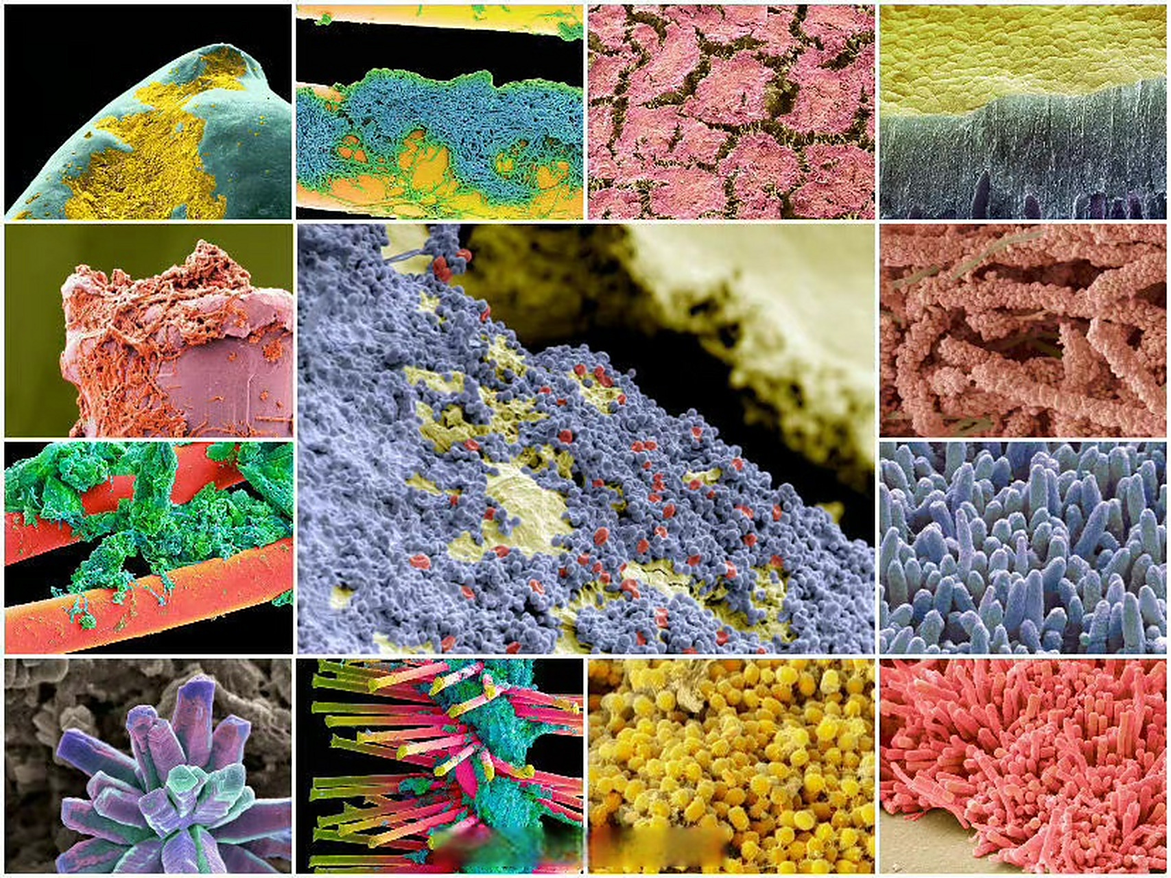 【#显微镜下的牙齿什么样#】口腔中的细菌不是孤军奋战,它们通过唾液