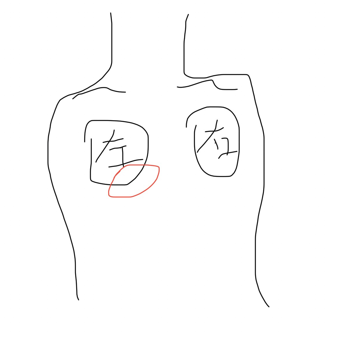 左胸下方痛是什么原因 女生左胸下方里面隐隐作痛  感觉怎么躺都不