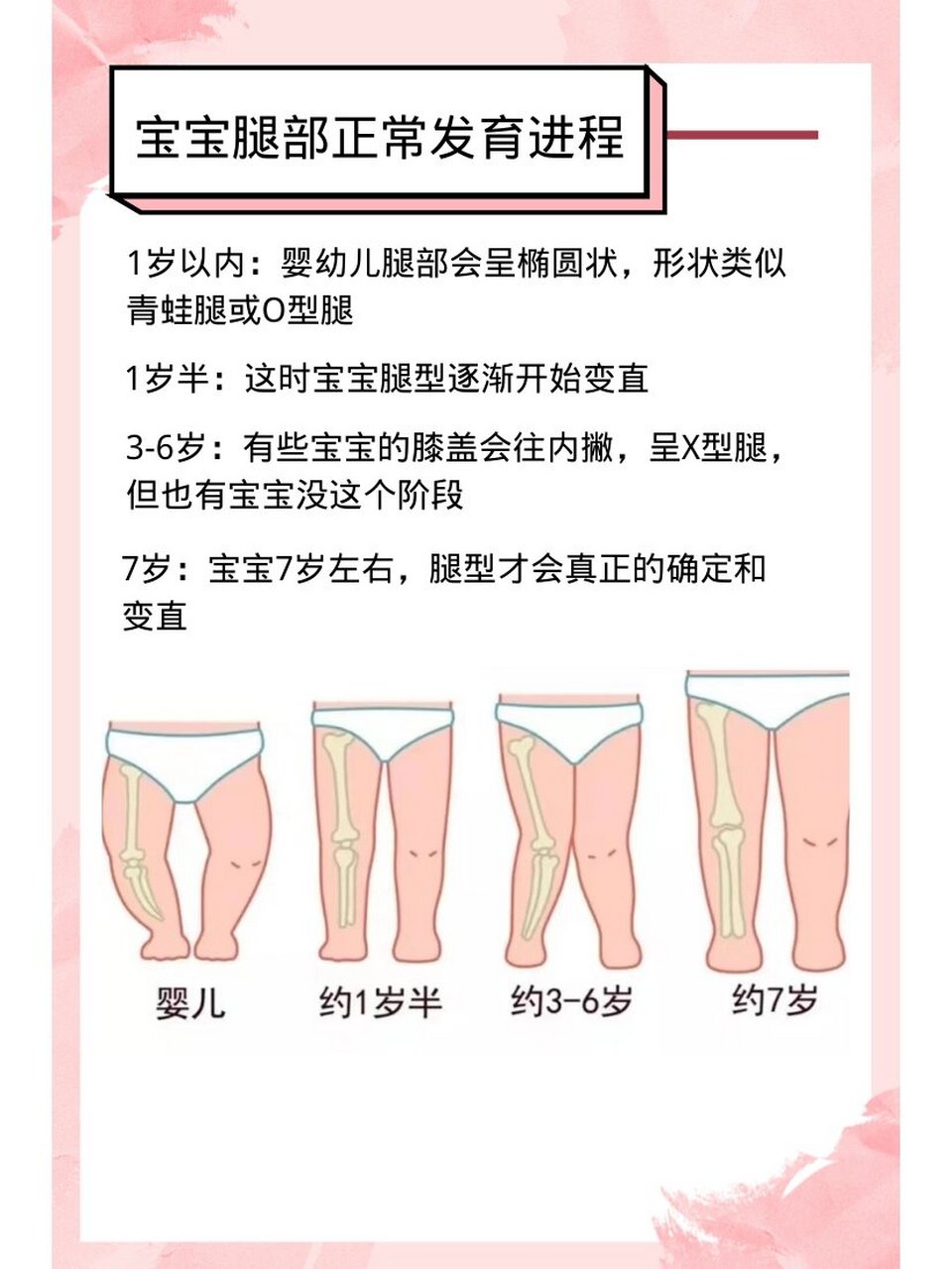 干货 |宝宝腿型正常发育过程6015 91正常宝宝的腿型应该是怎么