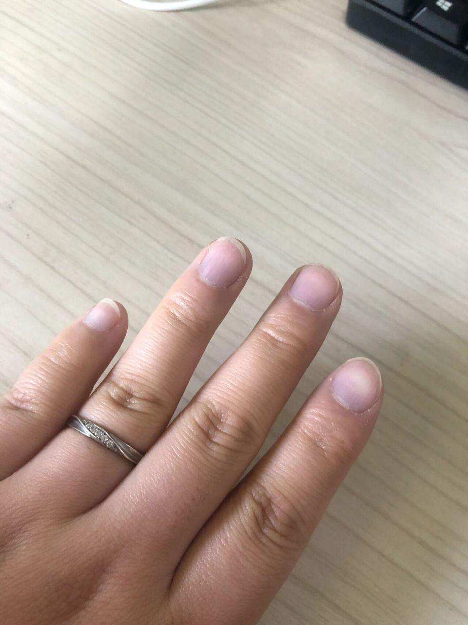 指甲盖发紫啥情况?