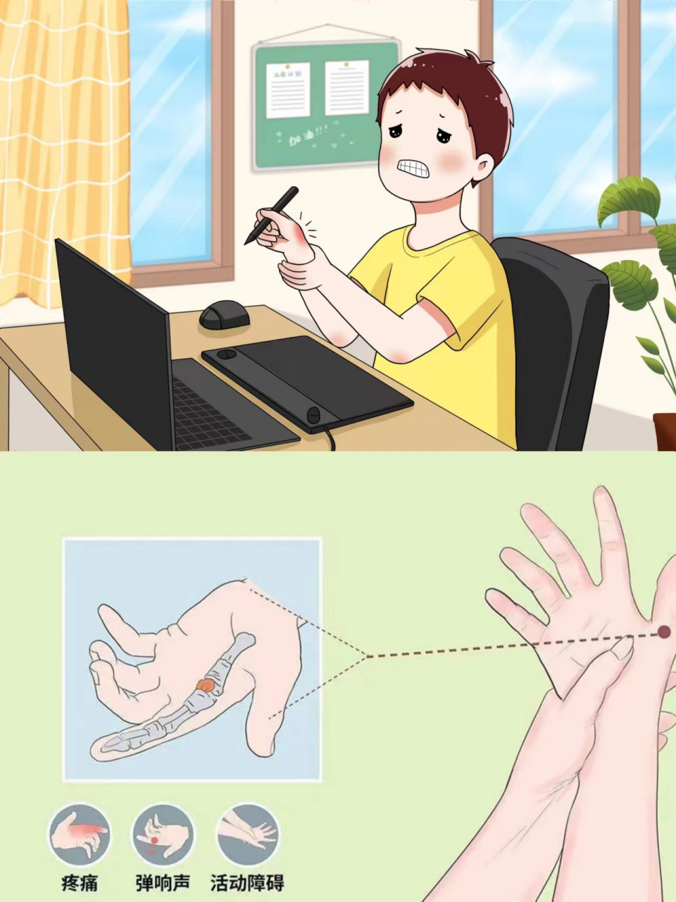 我也有腱鞘炎,这就是很多人常说的"鼠标手".