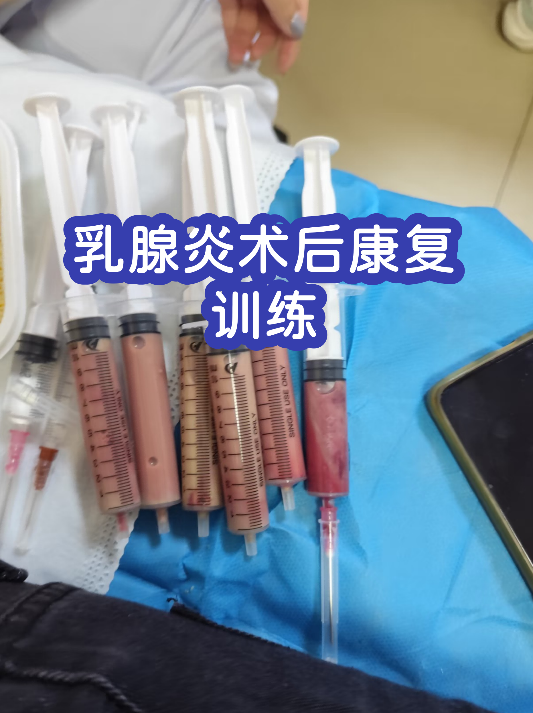 西苑医院住院办理陪诊挂号术后伤口护理协助，加快身体恢复的简单介绍