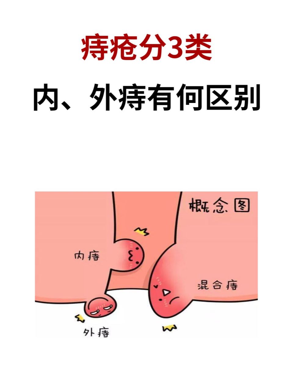 外痔和内痔怎么区分图片