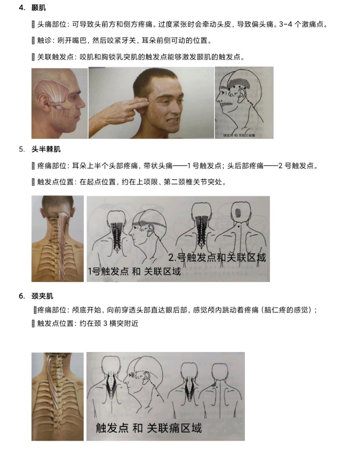 触发点 你是自己的按摩师