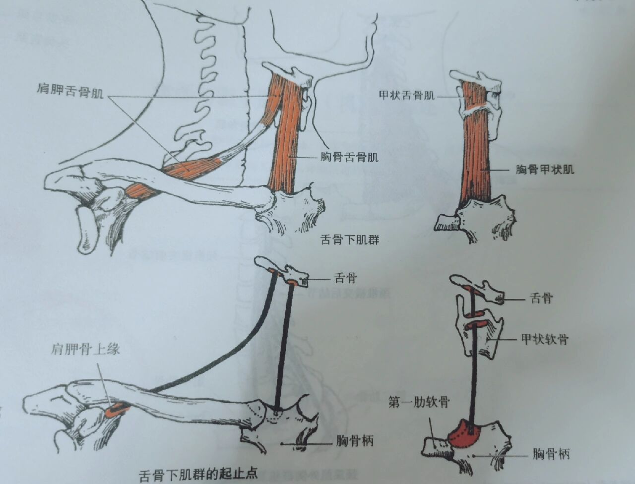 移行成中间键斜向内上方转为上腹