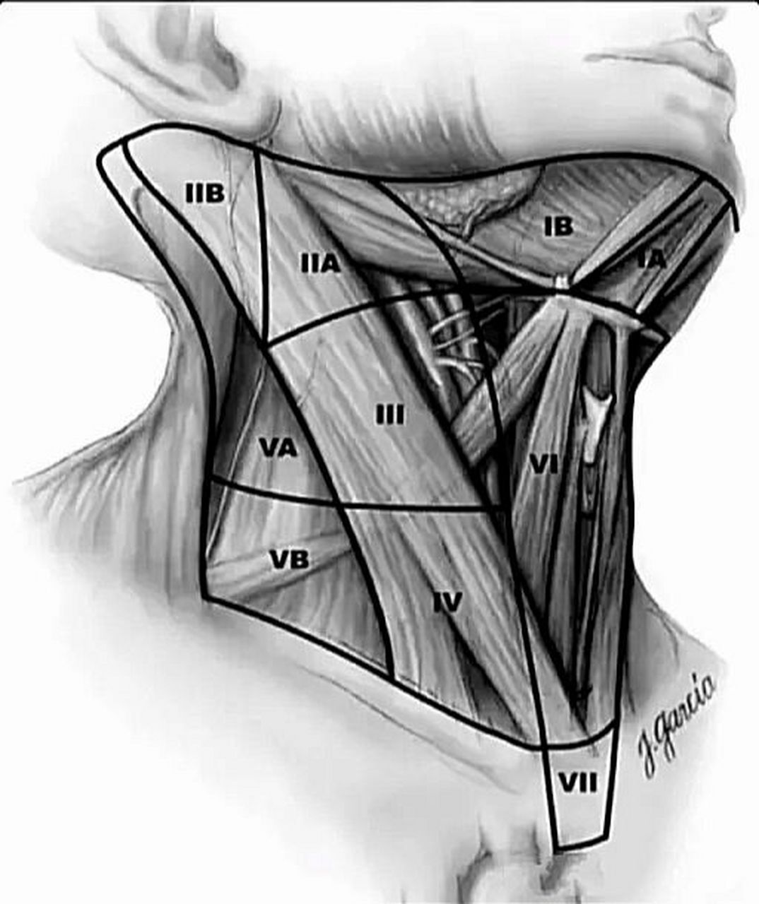 颈部淋巴结分区 Ⅰ区:包括颏下区及颌下区淋巴结,分布着大约1～14枚