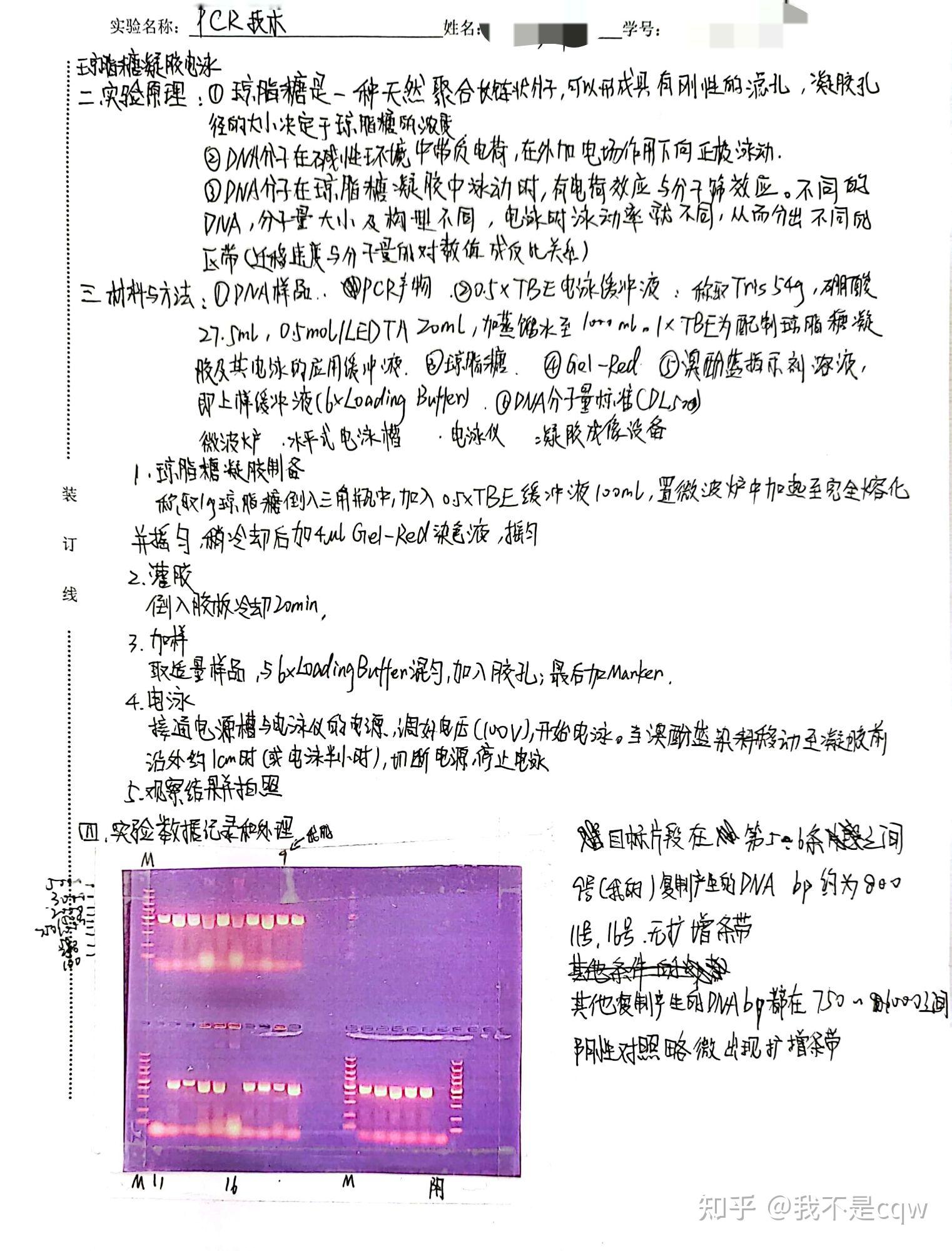 肾浊肿手绘实验报告图图片