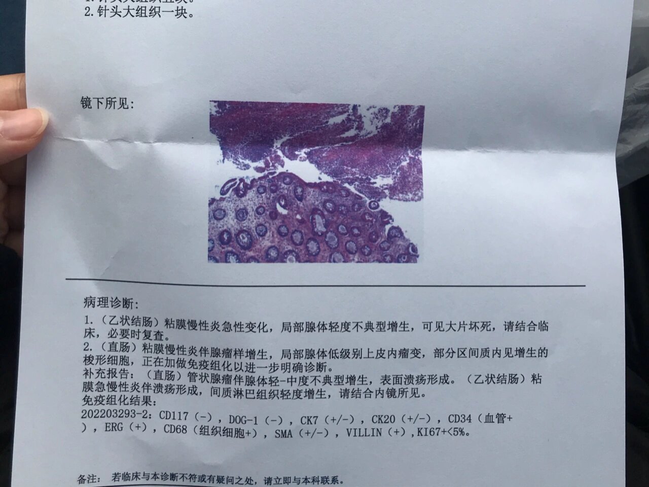 昨天取完病理报告就跑去上海复旦大学附属肿瘤医院再次提交病理检测