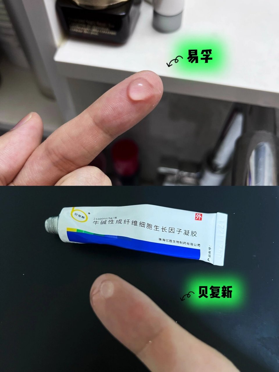 脂溢性皮炎导致皮肤屏障受损的大救星!
