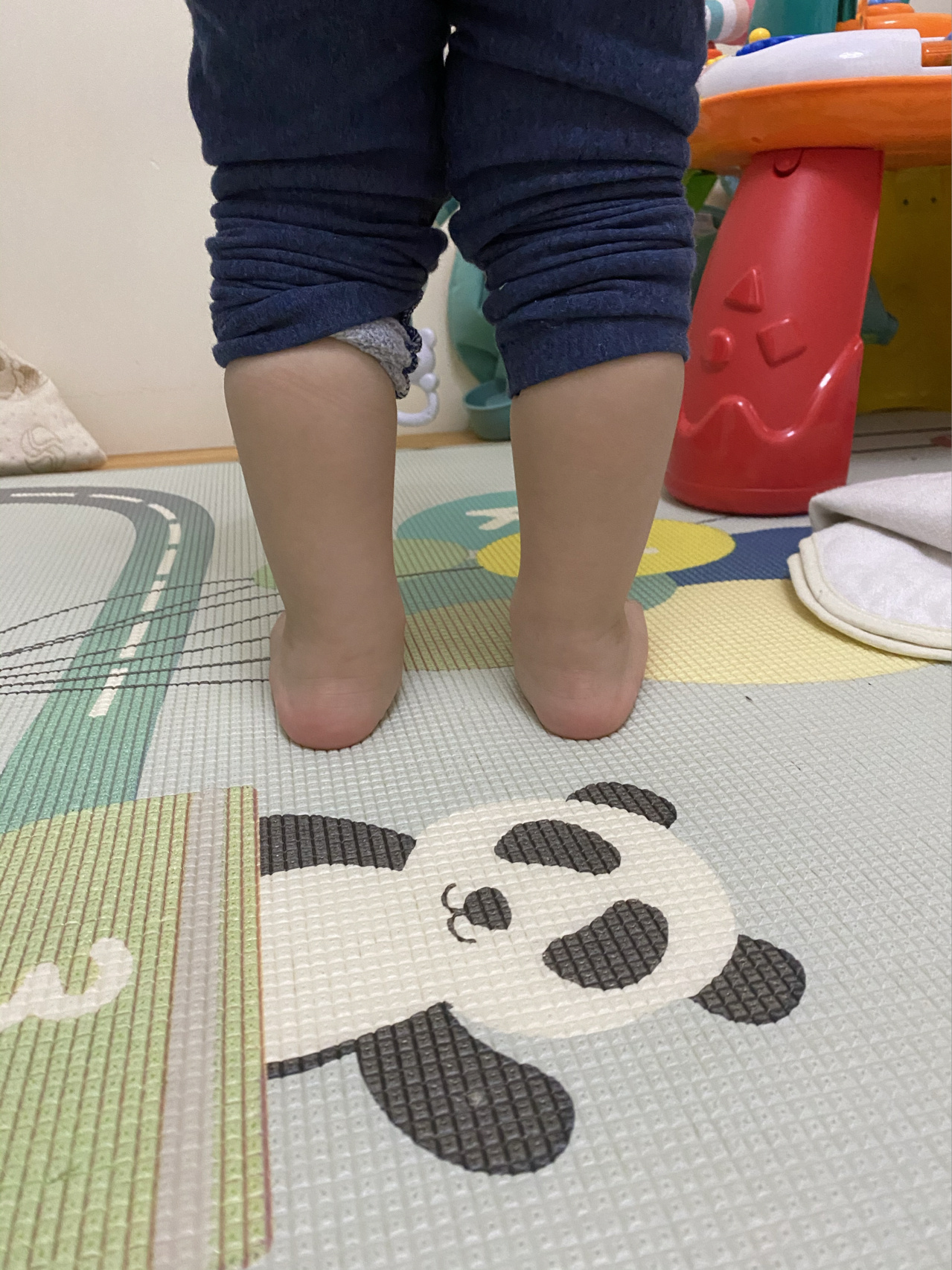 宝宝足外翻怎么办