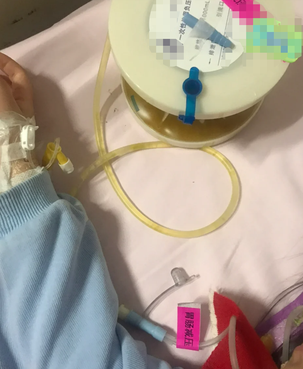 插胃管时,让病人取坐位或半卧位;如果坐起困难,就用右侧卧位