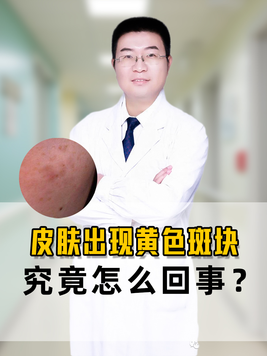 皮肤上突然出现黄色斑块可能由多种原因引起,无论何种原因,发现皮肤