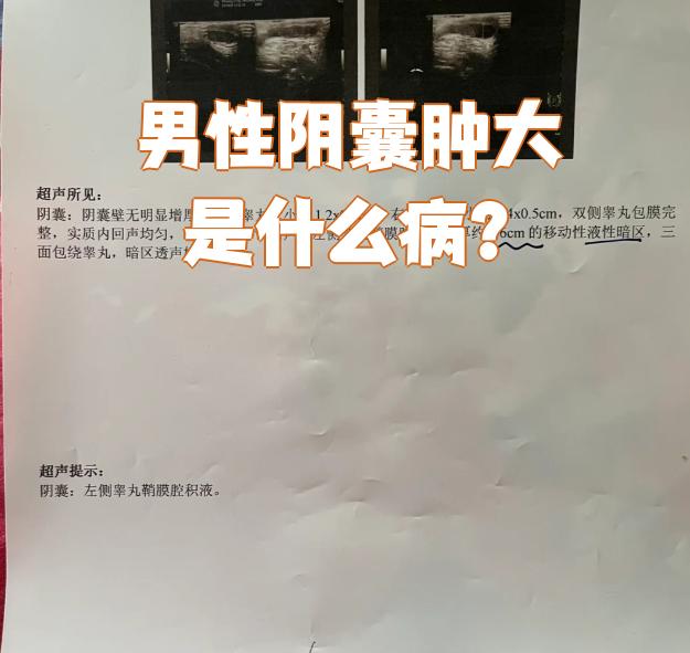 男性阴囊肿大是什么病?