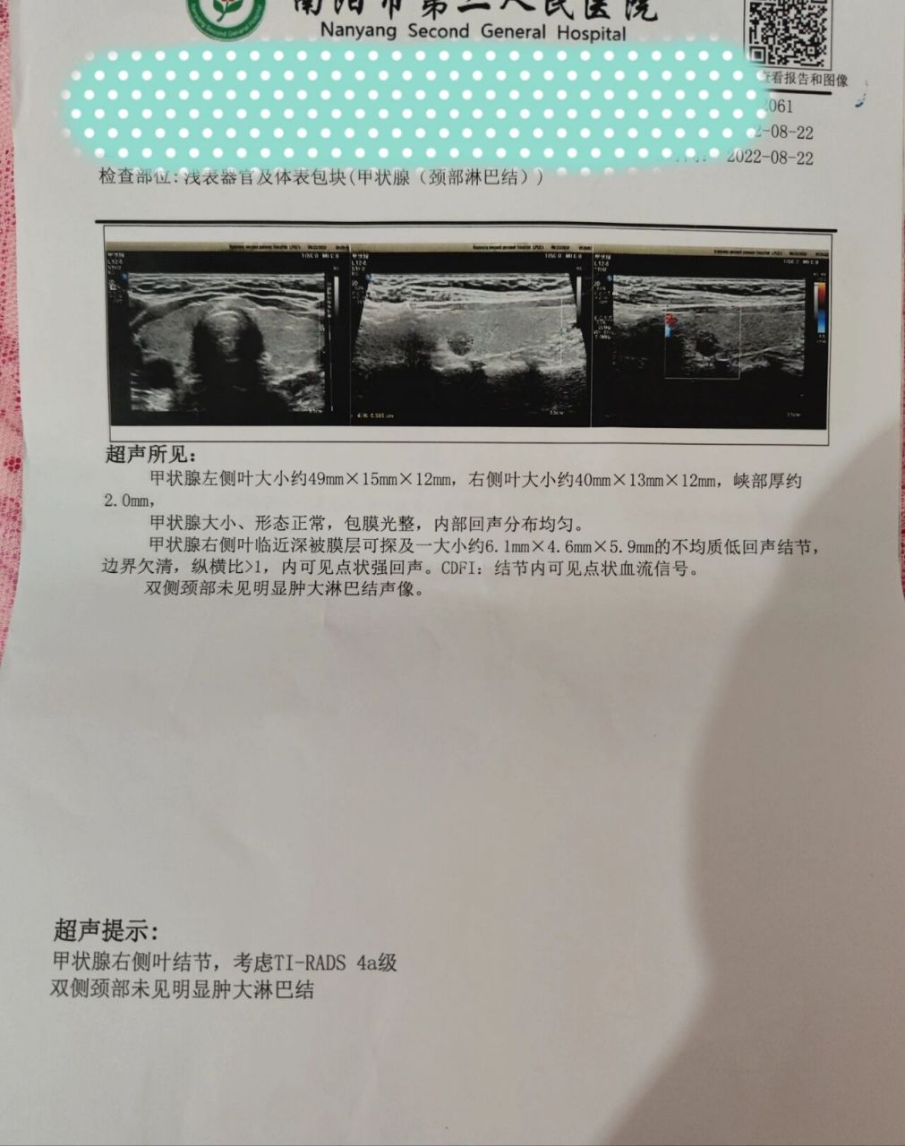 甲状腺结节4a,求推荐郑州好的医院 甲状腺结节有一年前了,一直都是