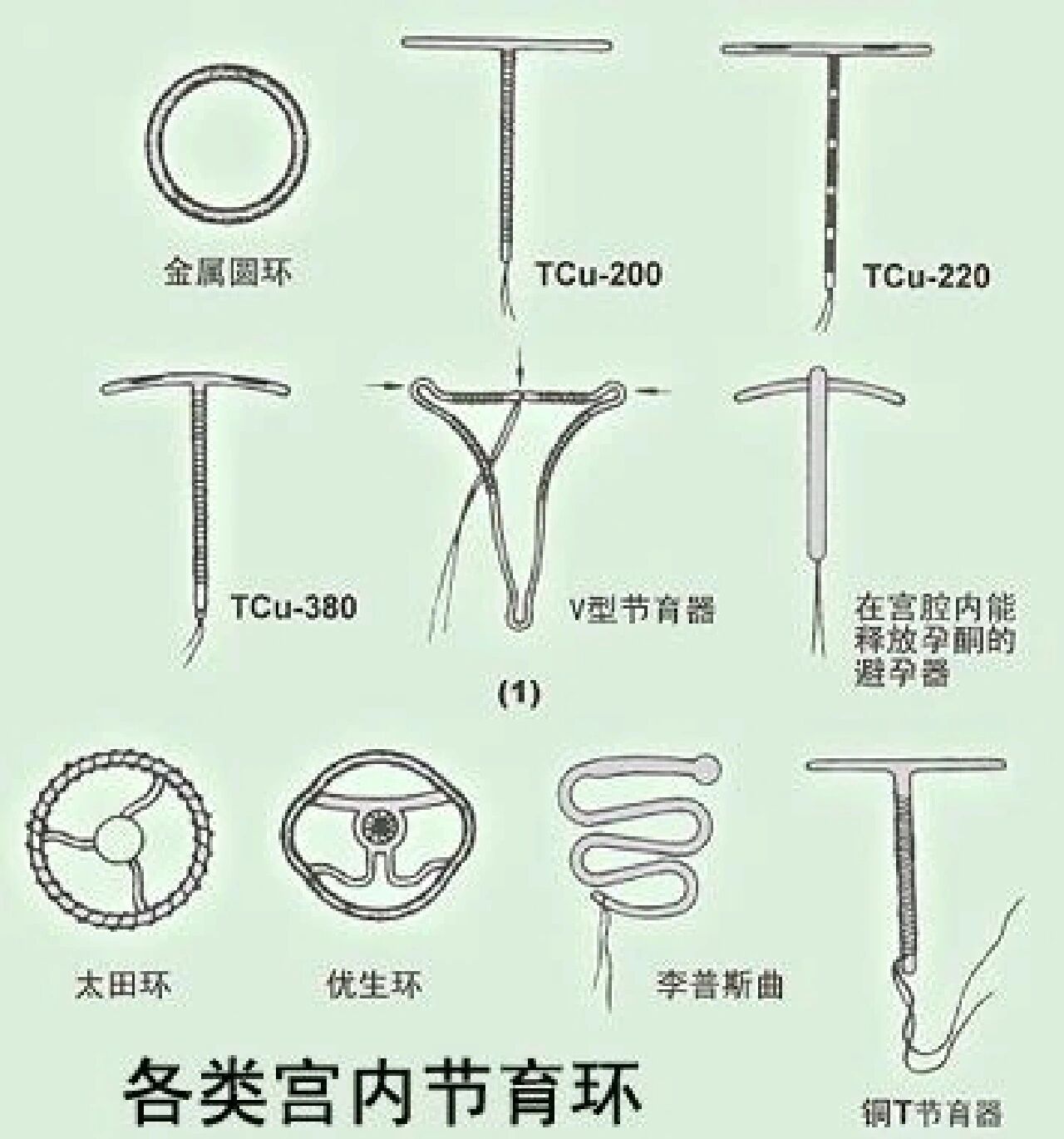 惰性宫内节育器顾名思义