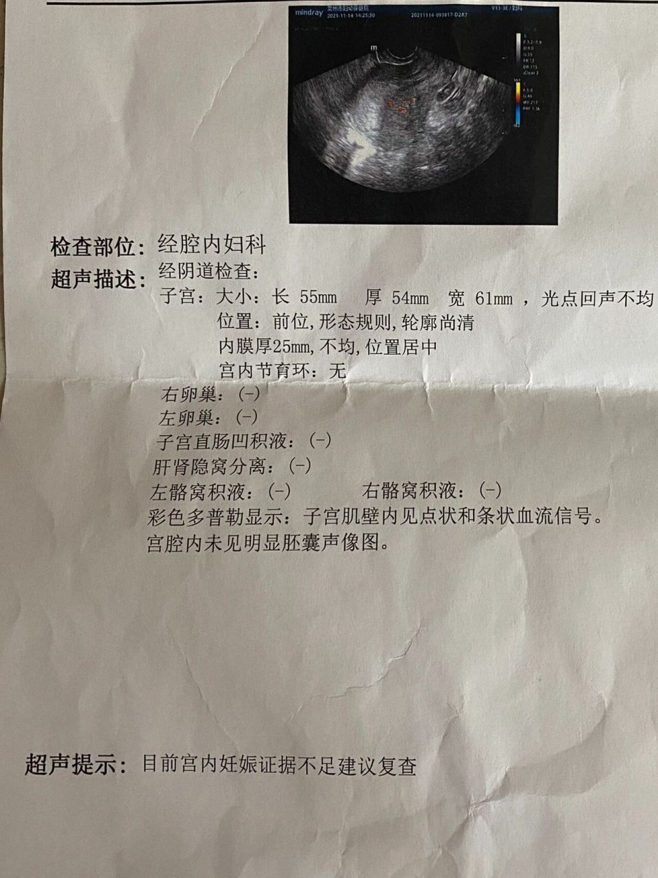 阴超没有看见孕囊 这两天心情大起大落的 末次月经10.
