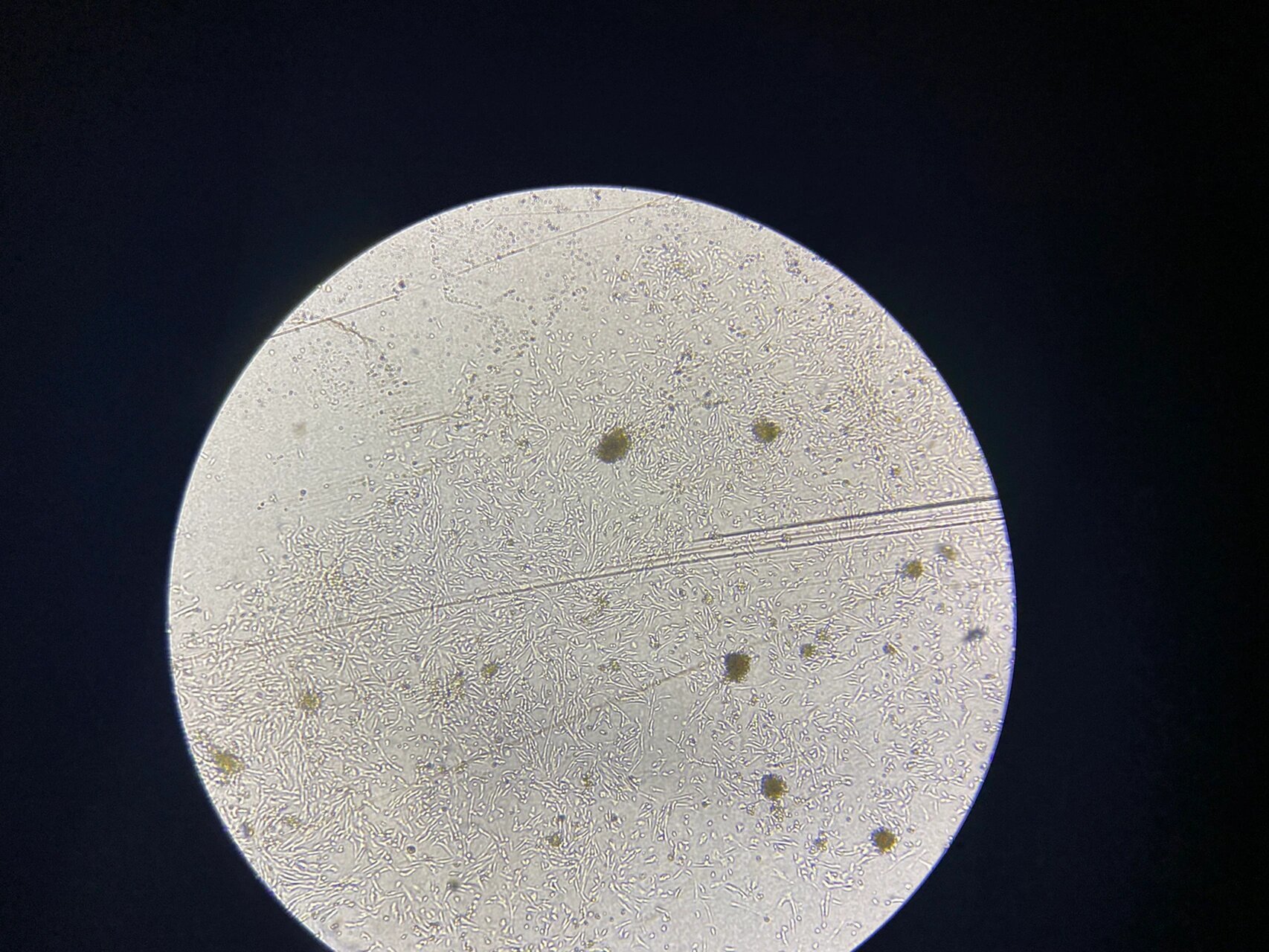 小鼠肾细胞原代培养第六天 养了6天的细胞,感觉长得还是好慢,后续老师