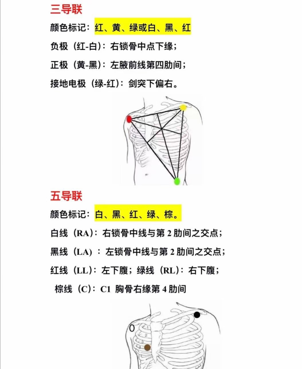 多通道十二导联心电图图片