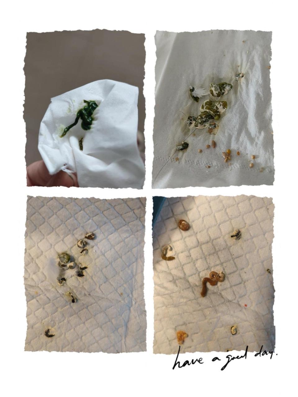 玄凤鹦鹉黏稠绿便治疗经验分享 75这病一定要提早发现尽快喂药治疗