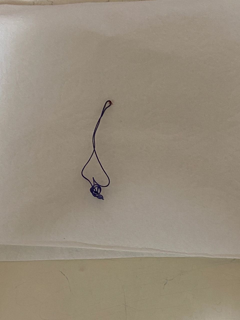 痔疮术后第十六天 刚才洗完澡涂药的时候,门口的线轻轻一拉就掉了