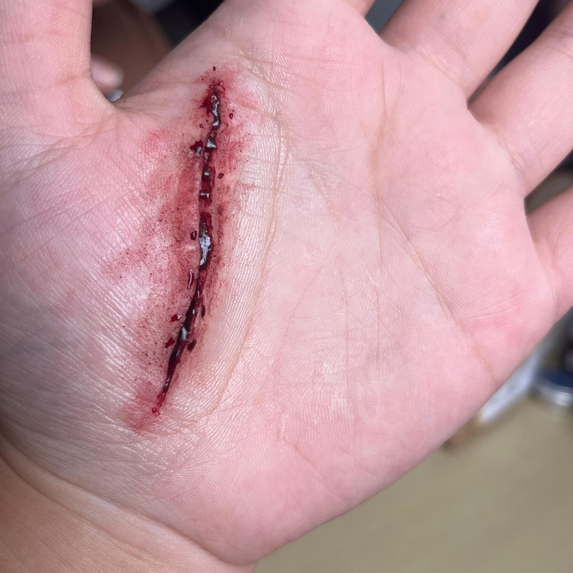 先拍下来… 影视化妆之刀伤