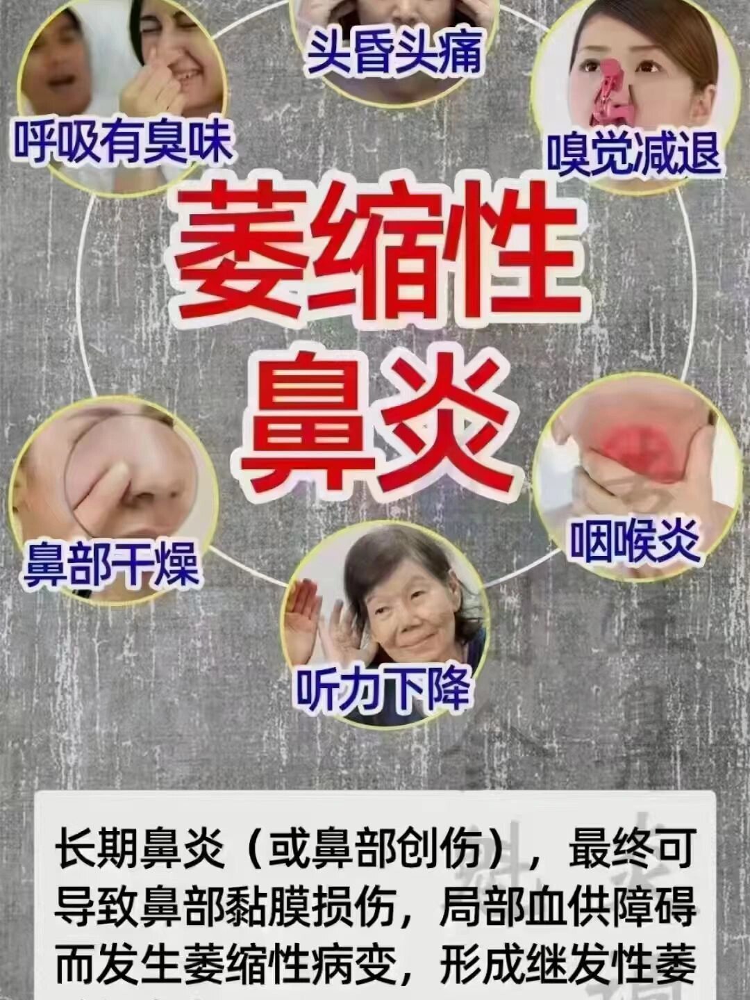赶紧看看,身体给你发了什么求救信号: 1,萎缩性鼻炎俗称"臭鼻症",当