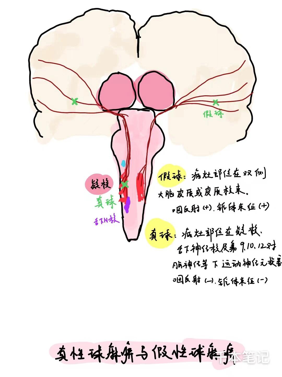 上行纤维束图片