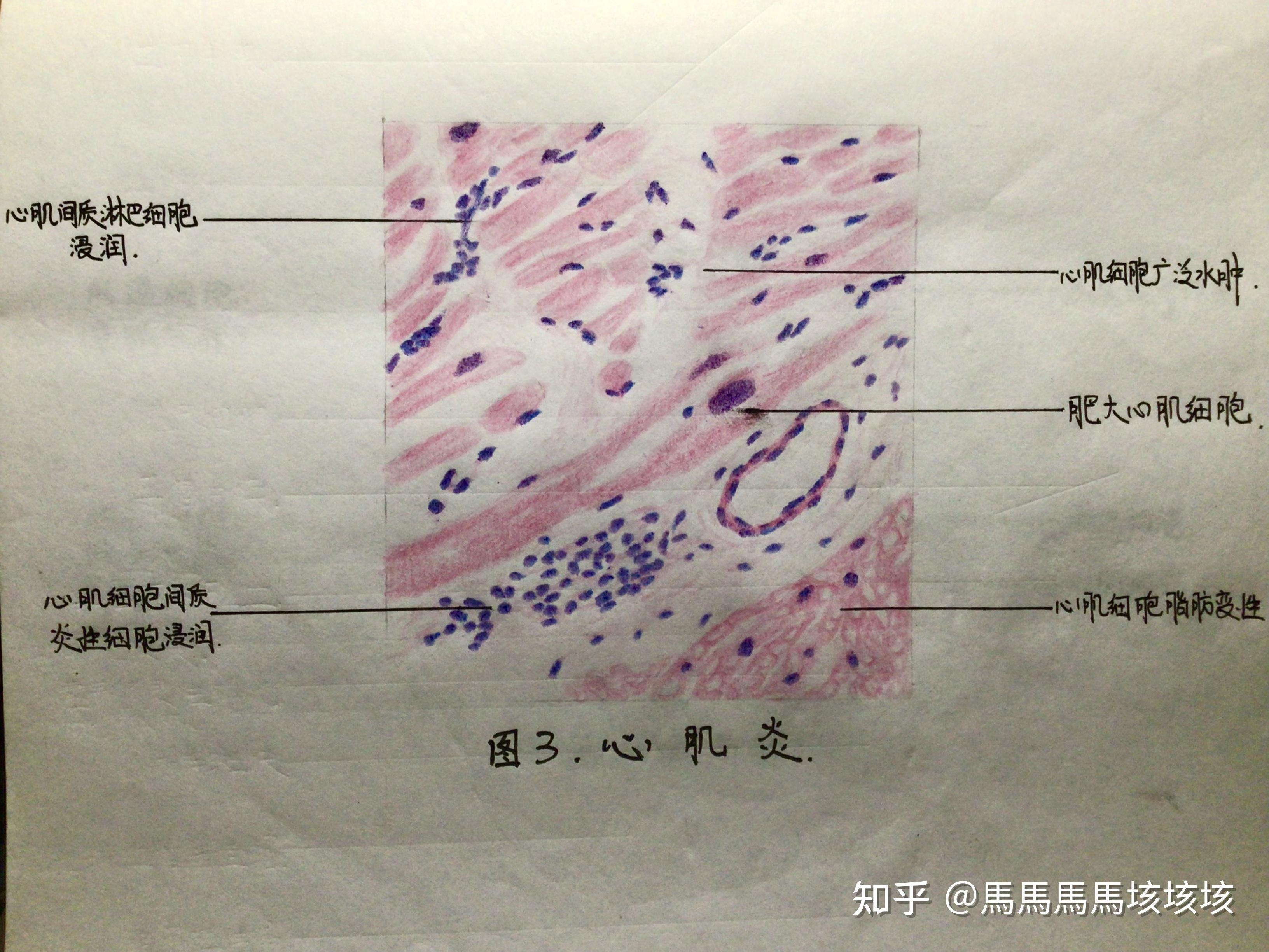 心肌细胞切片手绘图片