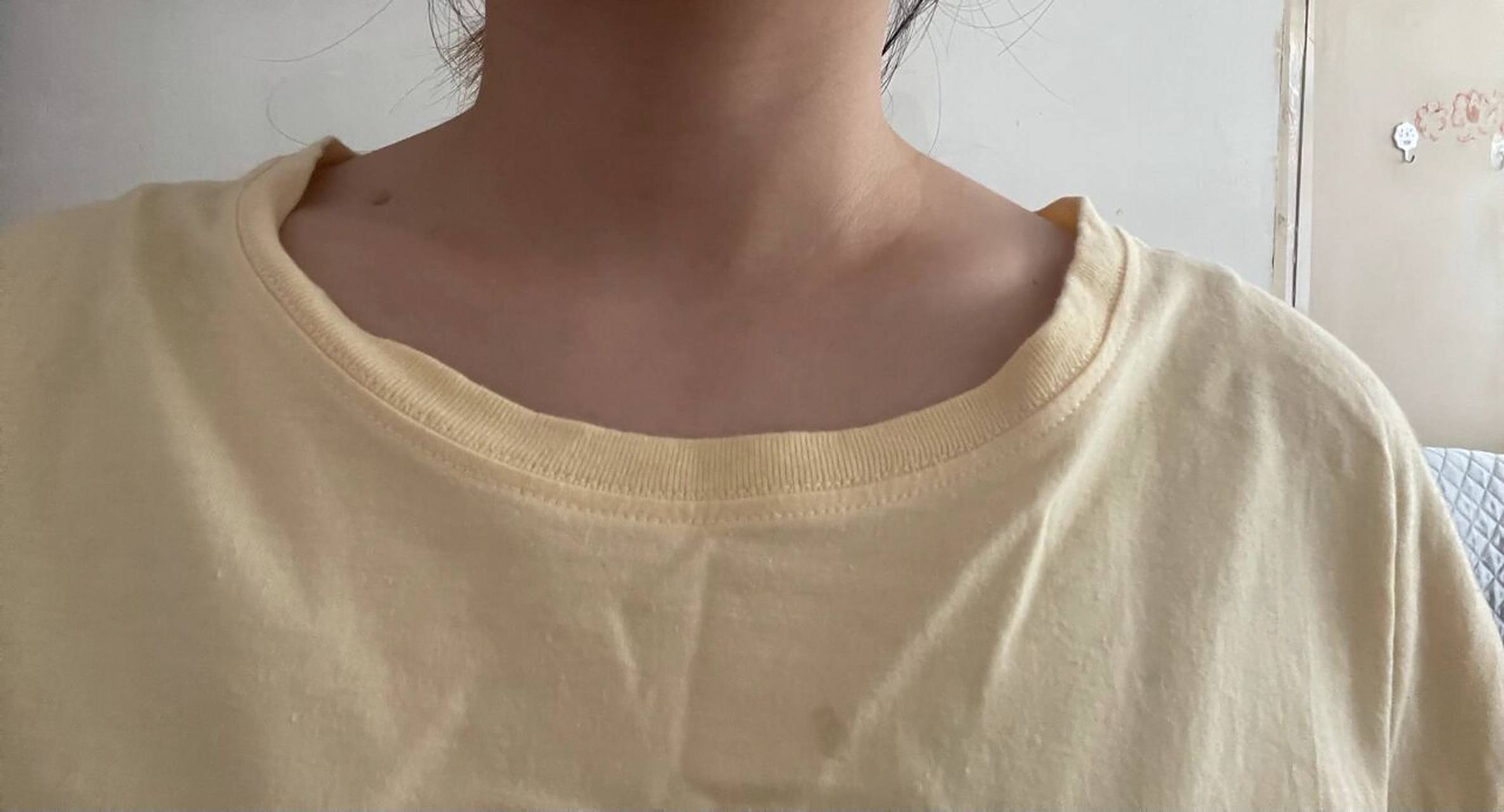 锁骨不对称 照镜子发现自己锁骨不对称,搜索了一下,发现大家的不对称