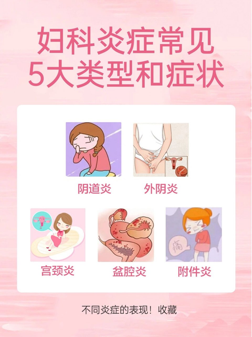 常见20种妇科病图片图片