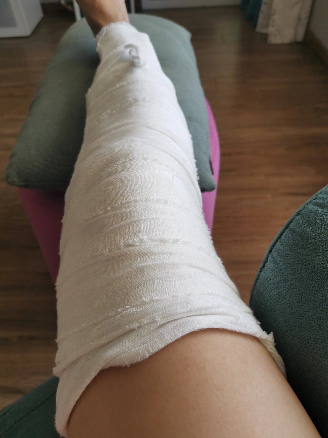 骨折图片 石膏绷带腿部摔伤包扎膝盖图片真实右腿髌骨骨折睡觉姿势